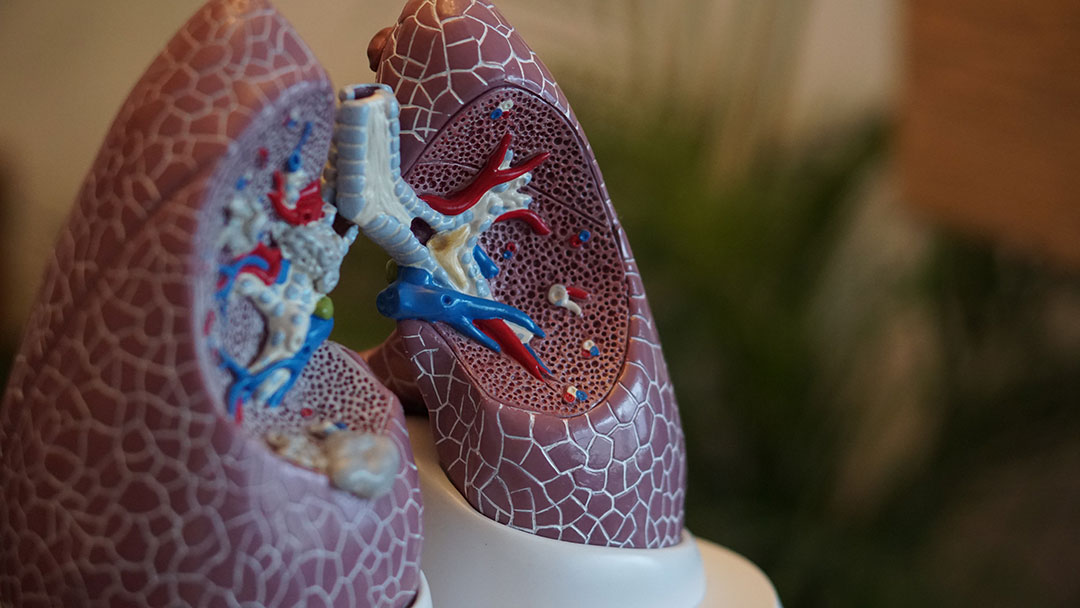 VOA Selected as one of 10 Sites for New Clinical Trial MYLUNG